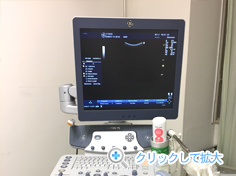 超音波エコー装置